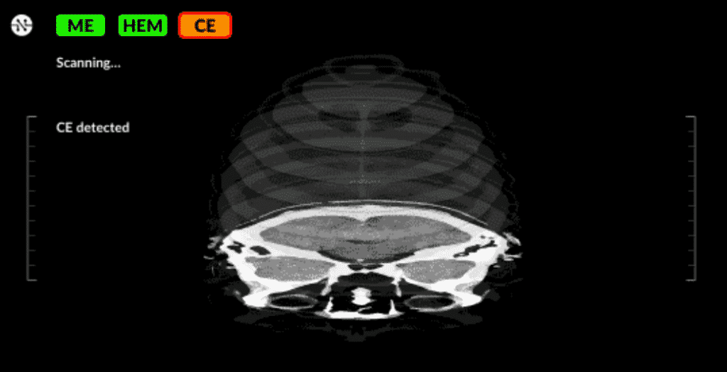 Nines software tries to assist the radiologist spot potential problems.